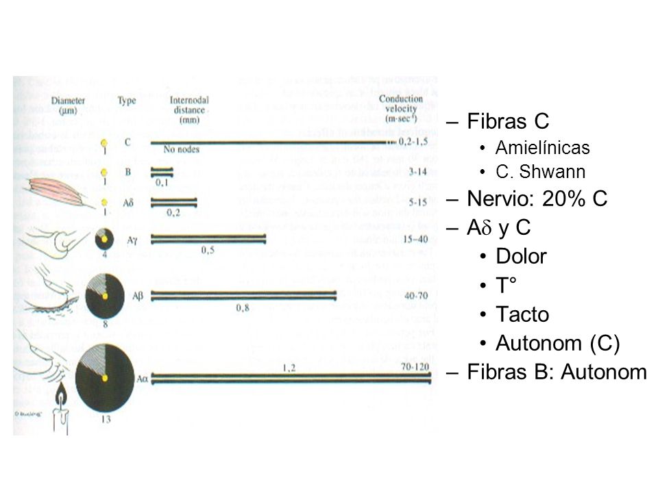 Fibras C Nervio: 20% C Ad y C Dolor T° Tacto Autonom (C)