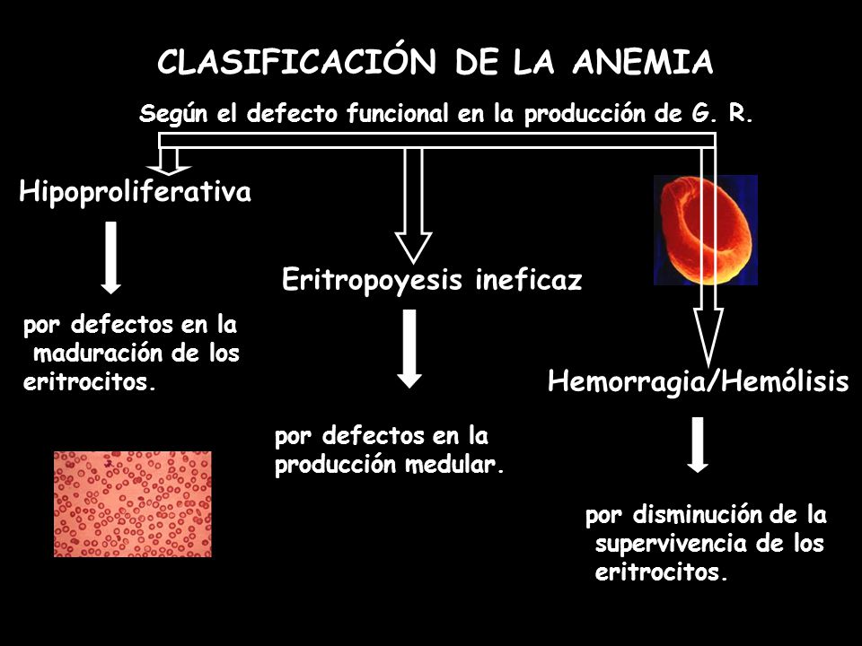Según el defecto funcional en la producción de G. R.