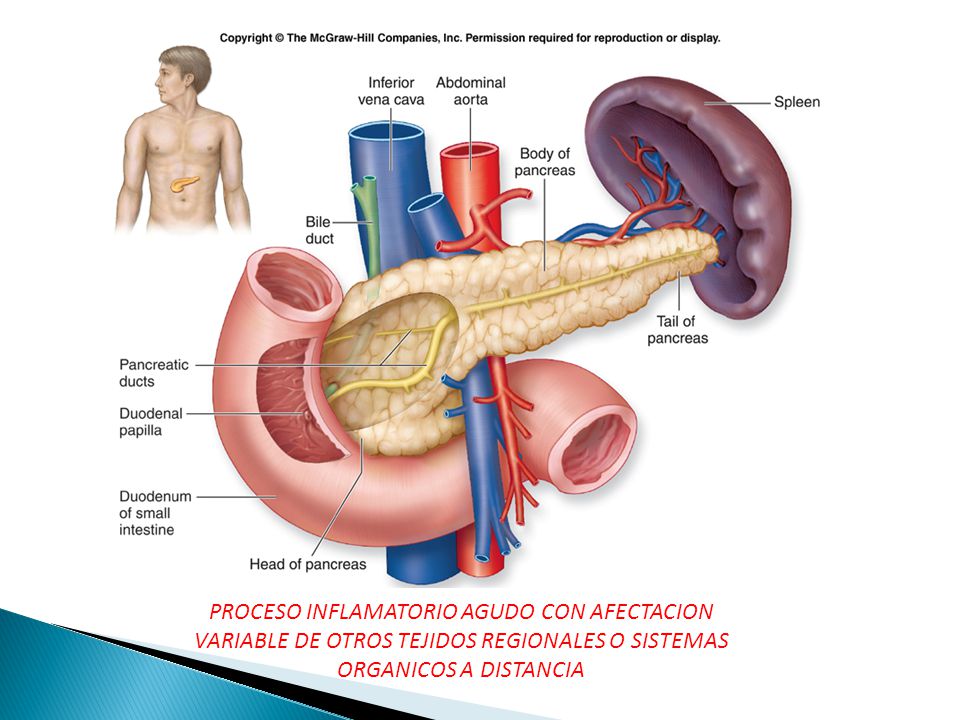 PROCESO INFLAMATORIO AGUDO CON AFECTACION VARIABLE DE OTROS TEJIDOS REGIONALES O SISTEMAS ORGANICOS A DISTANCIA