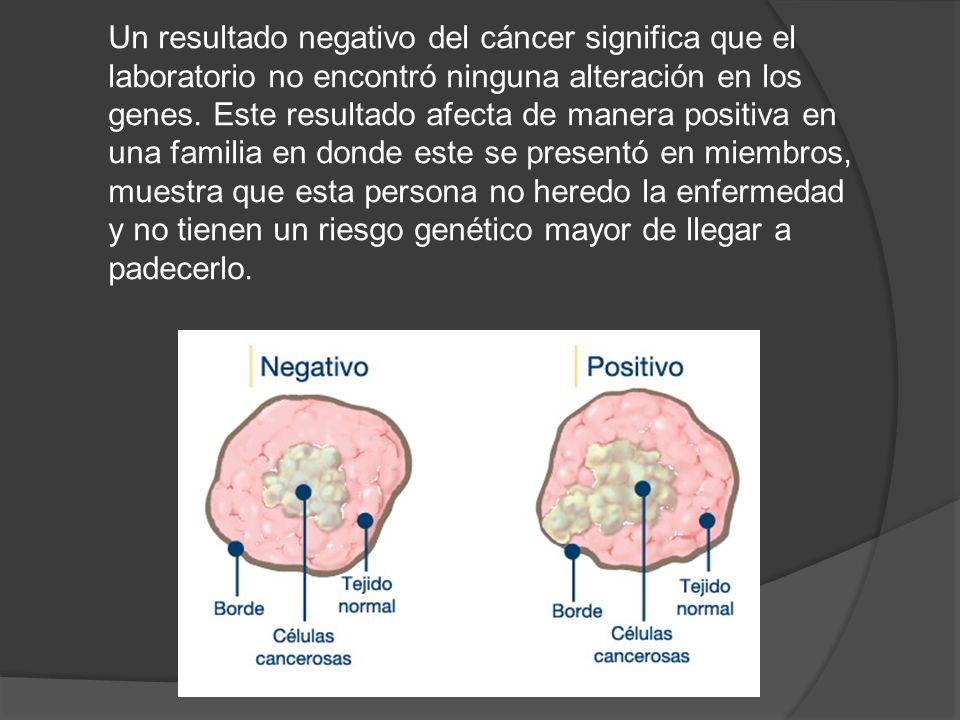 Un resultado negativo del cáncer significa que el laboratorio no encontró ninguna alteración en los genes.