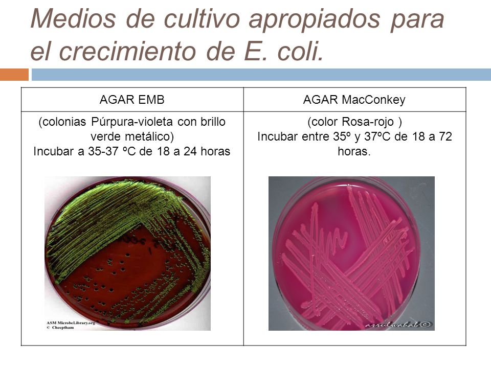 Medios de cultivo apropiados para el crecimiento de E. coli.