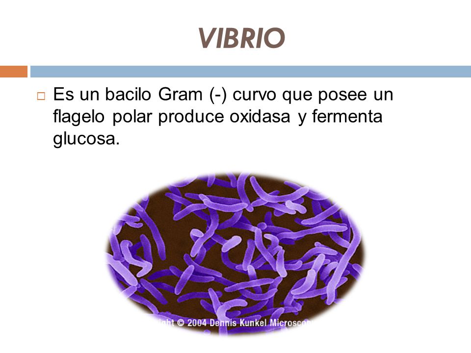 VIBRIO Es un bacilo Gram (-) curvo que posee un flagelo polar produce oxidasa y fermenta glucosa.