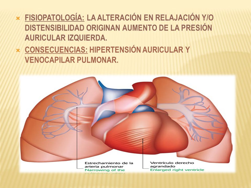 FISIOPATOLOGÍA: LA ALTERACIÓN EN RELAJACIÓN Y/O DISTENSIBILIDAD ORIGINAN AUMENTO DE LA PRESIÓN AURICULAR IZQUIERDA.
