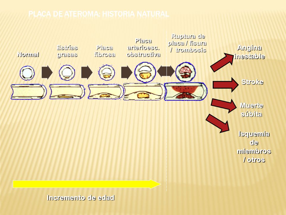 Ruptura de placa / fisura / trombosis Placa arterioesc. obstructiva