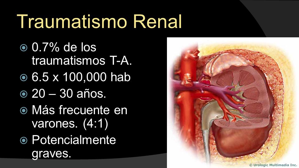 Traumatismo Renal 0.7% de los traumatismos T-A. 6.5 x 100,000 hab