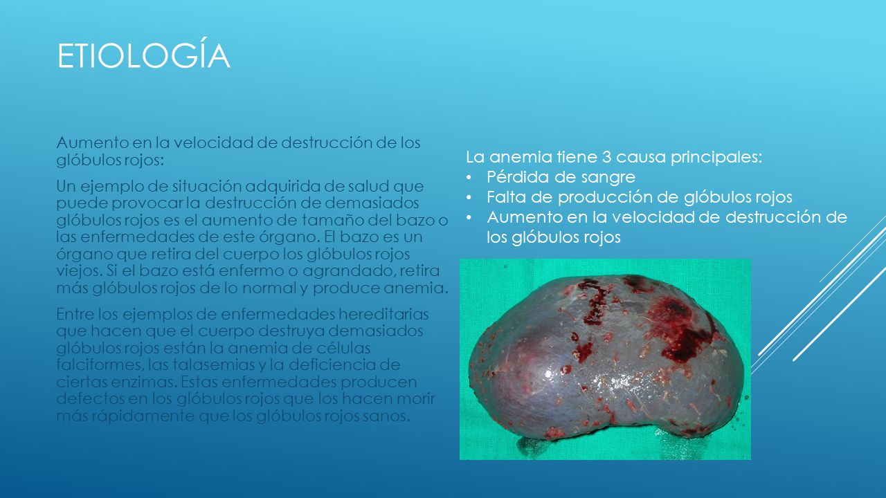 Etiología La anemia tiene 3 causa principales: Pérdida de sangre