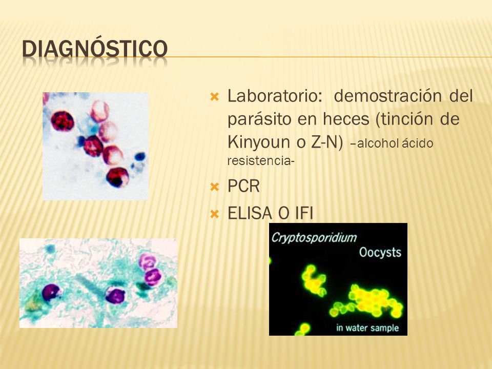 Diagnóstico Laboratorio: demostración del parásito en heces (tinción de Kinyoun o Z-N) –alcohol ácido resistencia-