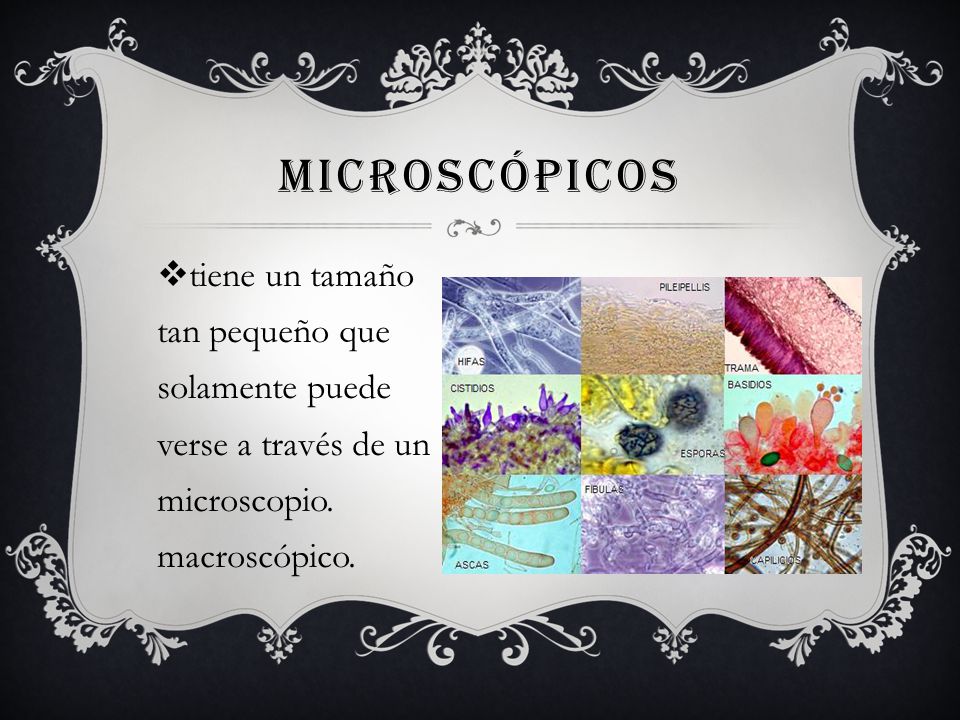microscópicos tiene un tamaño tan pequeño que solamente puede verse a través de un microscopio.
