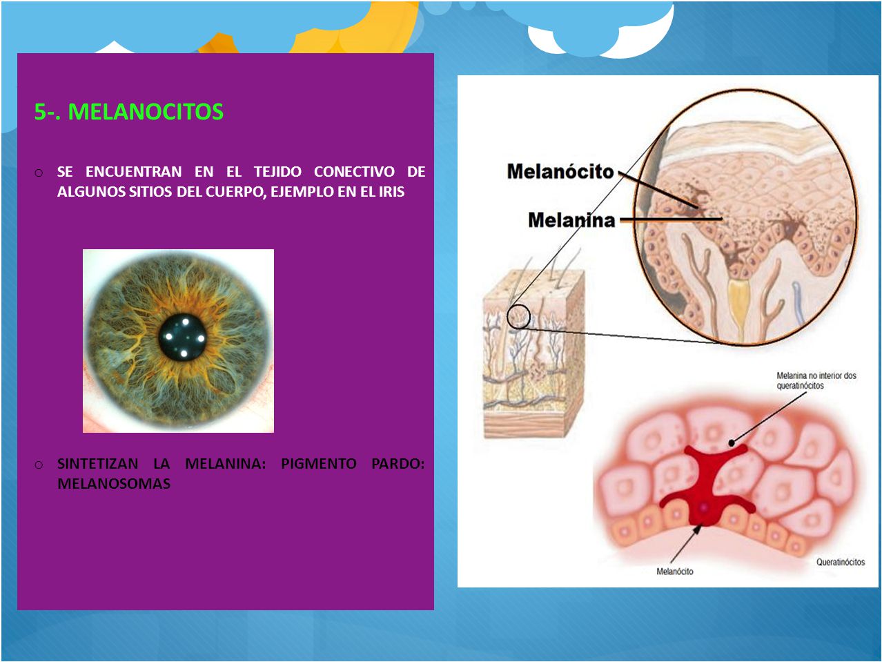 5-. MELANOCITOS SE ENCUENTRAN EN EL TEJIDO CONECTIVO DE ALGUNOS SITIOS DEL CUERPO, EJEMPLO EN EL IRIS.