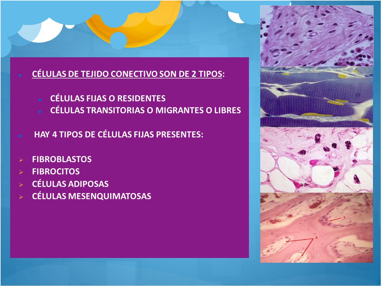 CÉLULAS DE TEJIDO CONECTIVO SON DE 2 TIPOS: