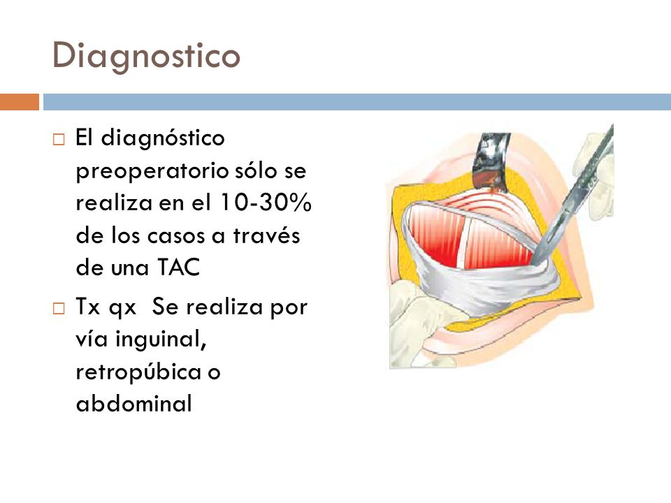 Diagnostico El diagnóstico preoperatorio sólo se realiza en el 10-30% de los casos a través de una TAC.