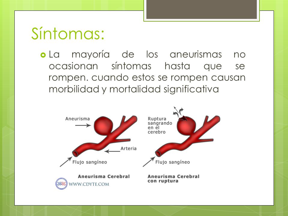 Síntomas: La mayoría de los aneurismas no ocasionan síntomas hasta que se rompen.