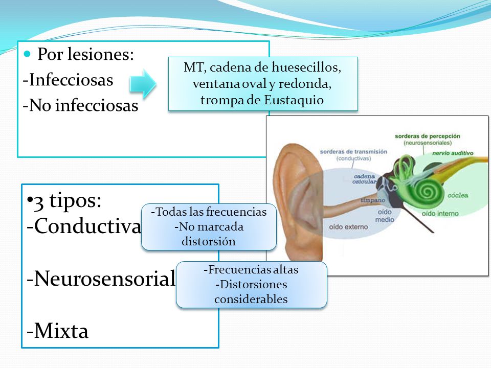 3 tipos: -Conductiva -Neurosensorial -Mixta Por lesiones: -Infecciosas