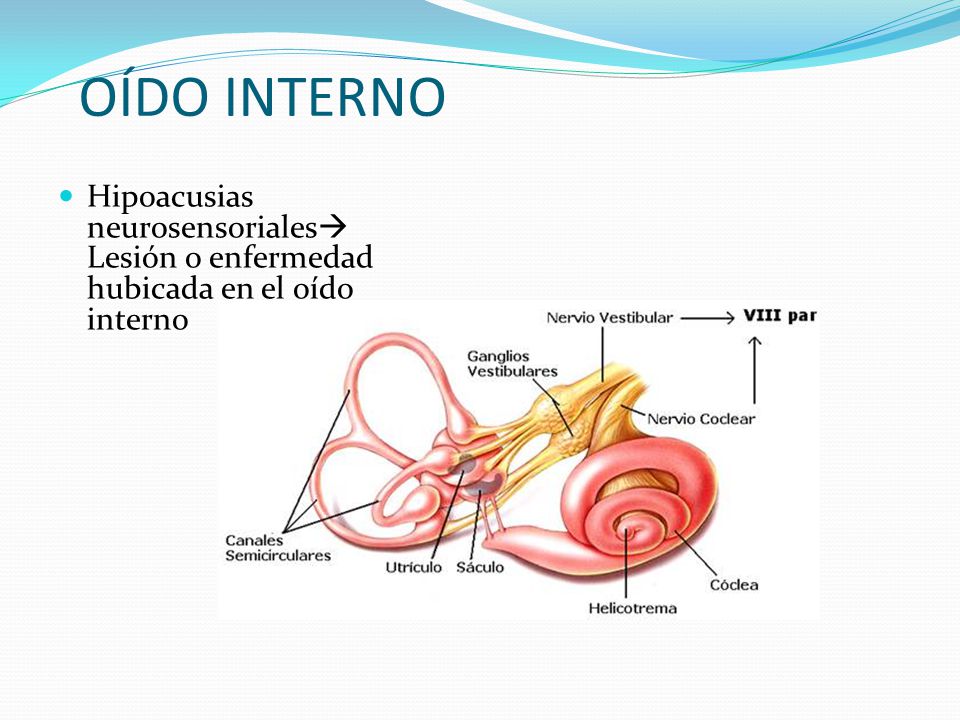 OÍDO INTERNO Hipoacusias neurosensoriales Lesión o enfermedad hubicada en el oído interno