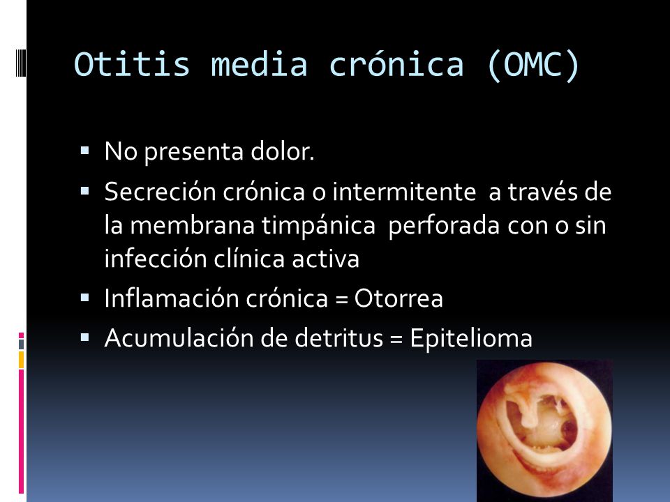 Otitis media crónica (OMC)