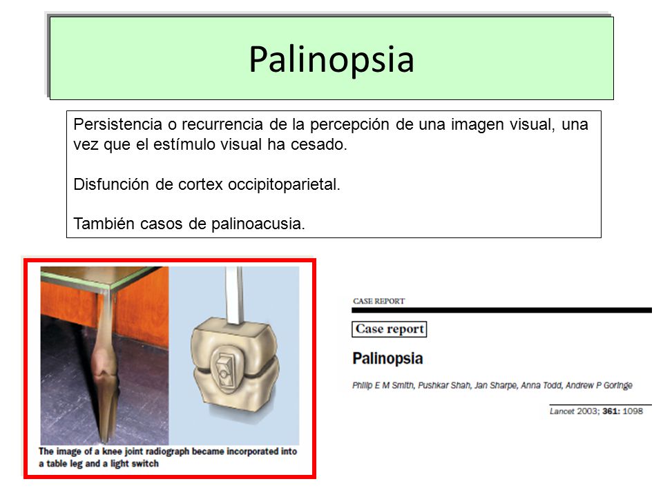 Palinopsia Persistencia o recurrencia de la percepción de una imagen visual, una. vez que el estímulo visual ha cesado.