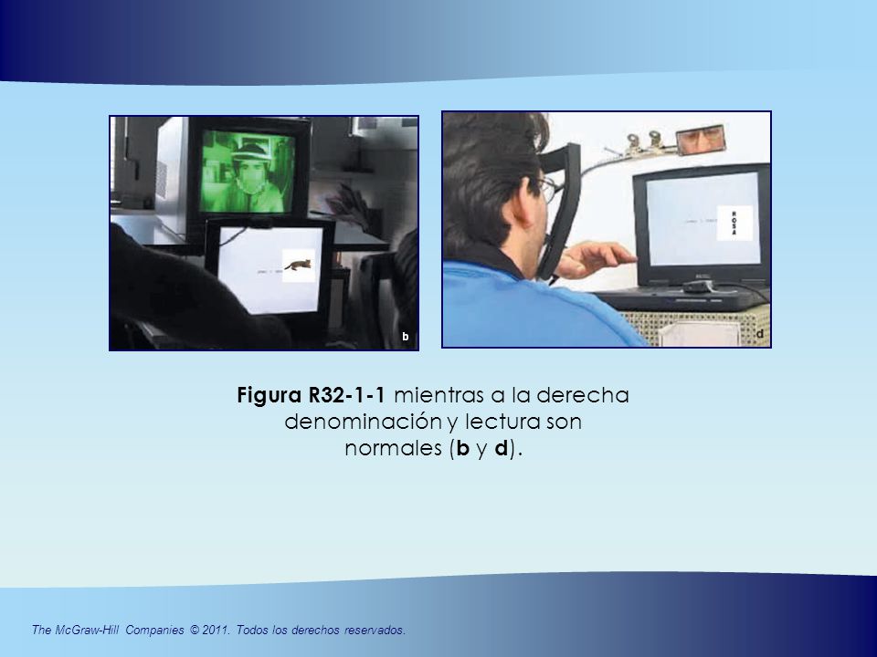 Figura R mientras a la derecha denominación y lectura son normales (b y d).