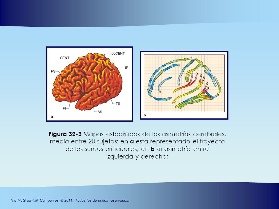 Figura 32-3 Mapas estadísticos de las asimetrías cerebrales, media entre 20 sujetos: en a está representado el trayecto de los surcos principales, en b su asimetría entre izquierda y derecha;