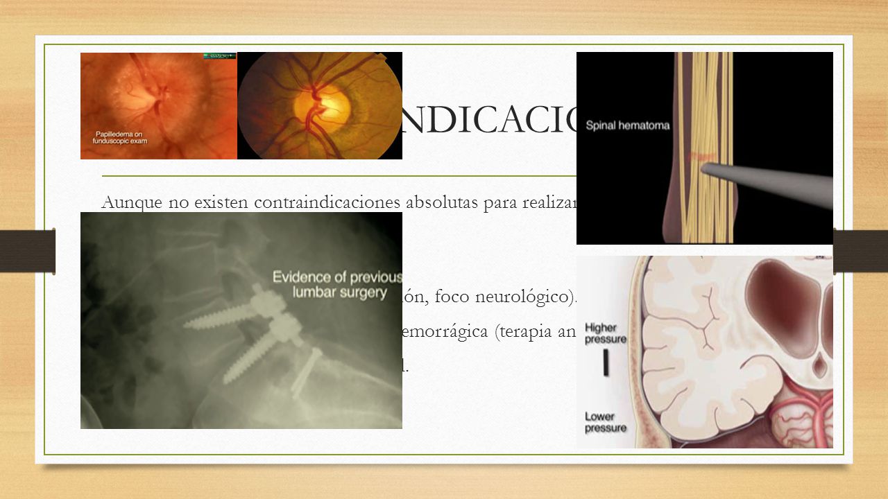 CONTRAINDICACIONES Aunque no existen contraindicaciones absolutas para realizar el procedimiento, se debe tener precaución en pacientes con: