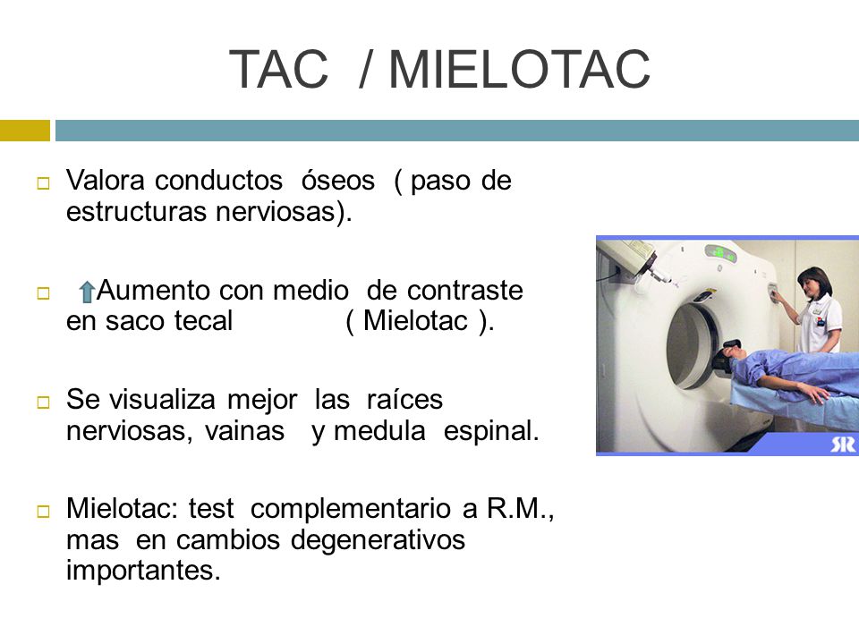 TAC / MIELOTAC Valora conductos óseos ( paso de estructuras nerviosas).