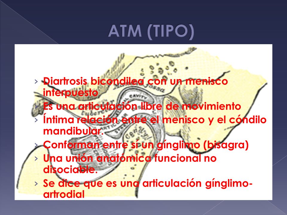 ATM (TIPO) Diartrosis bicondilea con un menisco interpuesto