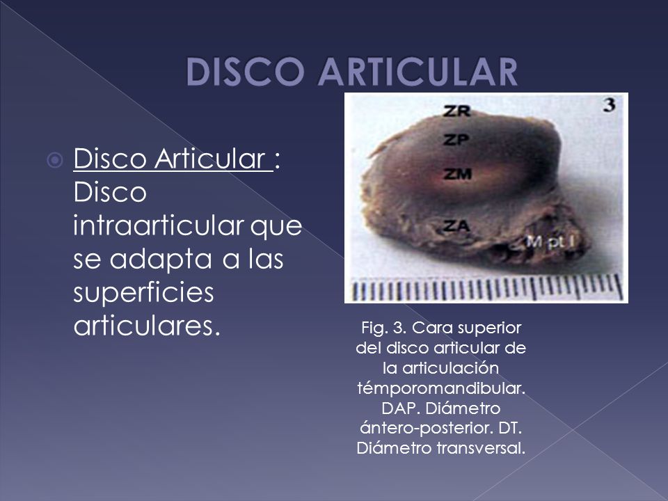 DISCO ARTICULAR Disco Articular : Disco intraarticular que se adapta a las superficies articulares.