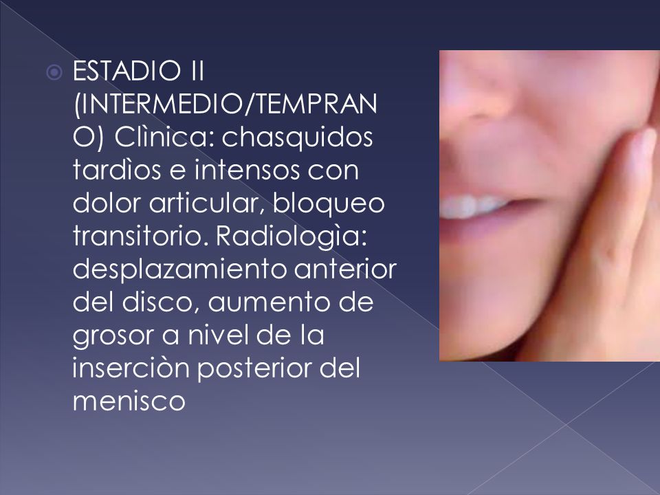 ESTADIO II (INTERMEDIO/TEMPRANO) Clìnica: chasquidos tardìos e intensos con dolor articular, bloqueo transitorio.