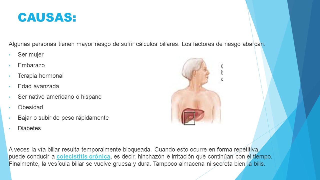 CAUSAS: Algunas personas tienen mayor riesgo de sufrir cálculos biliares. Los factores de riesgo abarcan: