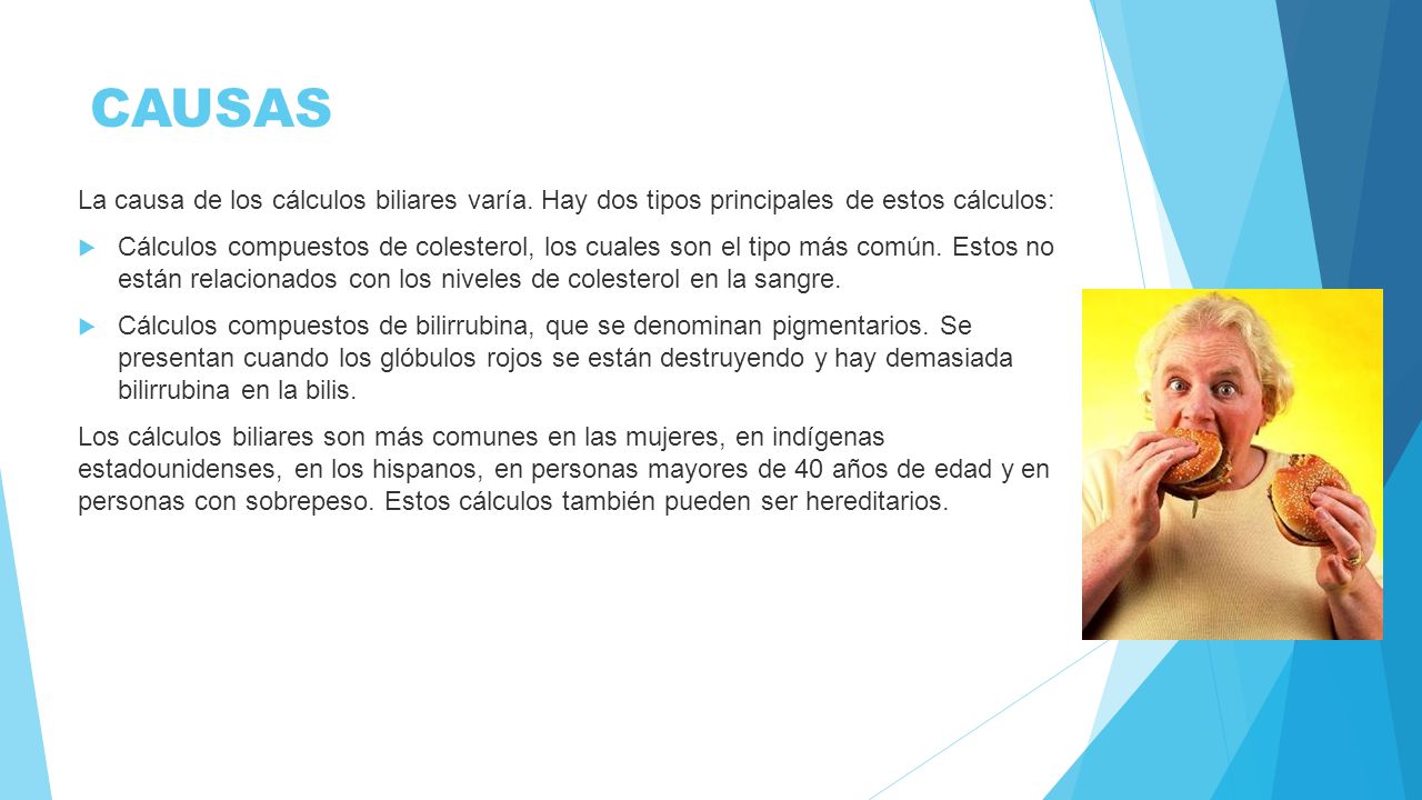 CAUSAS La causa de los cálculos biliares varía. Hay dos tipos principales de estos cálculos: