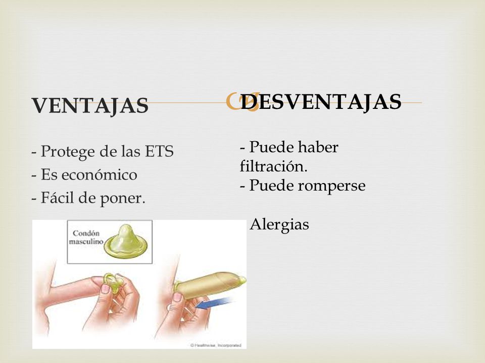 DESVENTAJAS VENTAJAS - Puede haber filtración. - Protege de las ETS