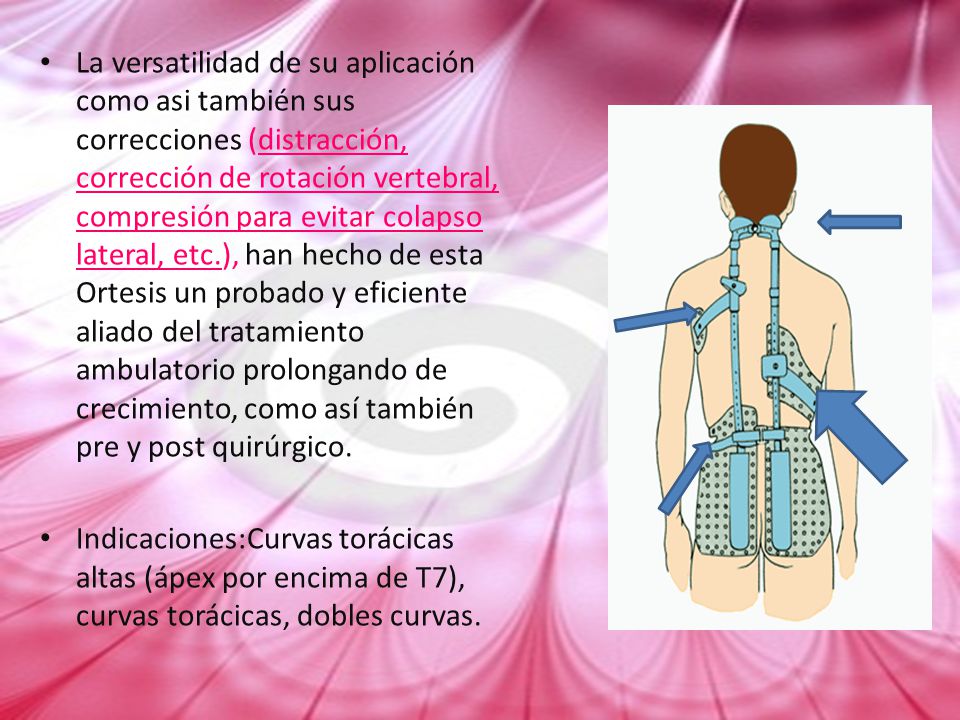 La versatilidad de su aplicación como asi también sus correcciones (distracción, corrección de rotación vertebral, compresión para evitar colapso lateral, etc.), han hecho de esta Ortesis un probado y eficiente aliado del tratamiento ambulatorio prolongando de crecimiento, como así también pre y post quirúrgico.