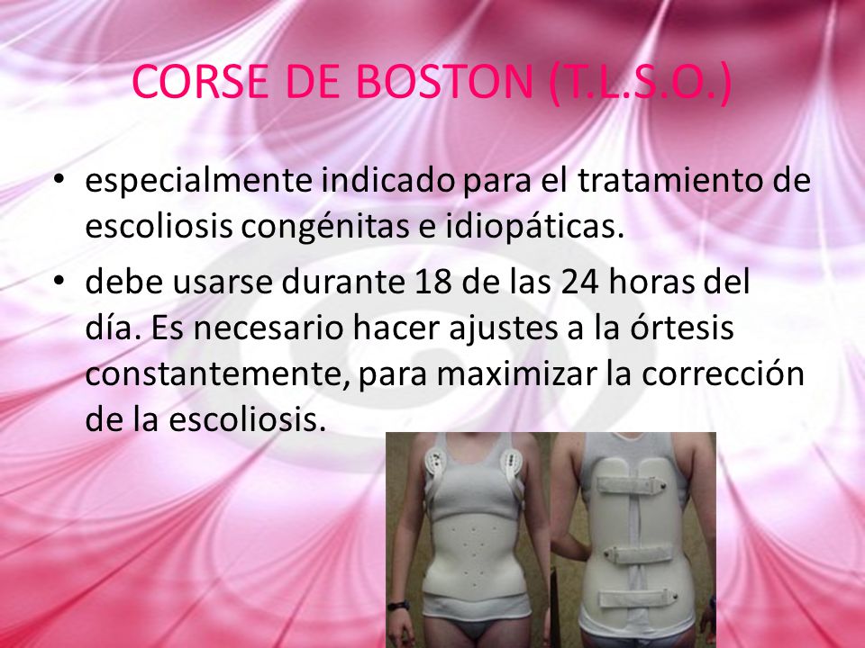 CORSE DE BOSTON (T.L.S.O.) especialmente indicado para el tratamiento de escoliosis congénitas e idiopáticas.