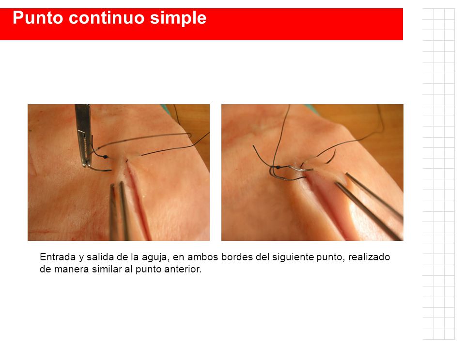 Punto continuo simple Entrada y salida de la aguja, en ambos bordes del siguiente punto, realizado de manera similar al punto anterior.