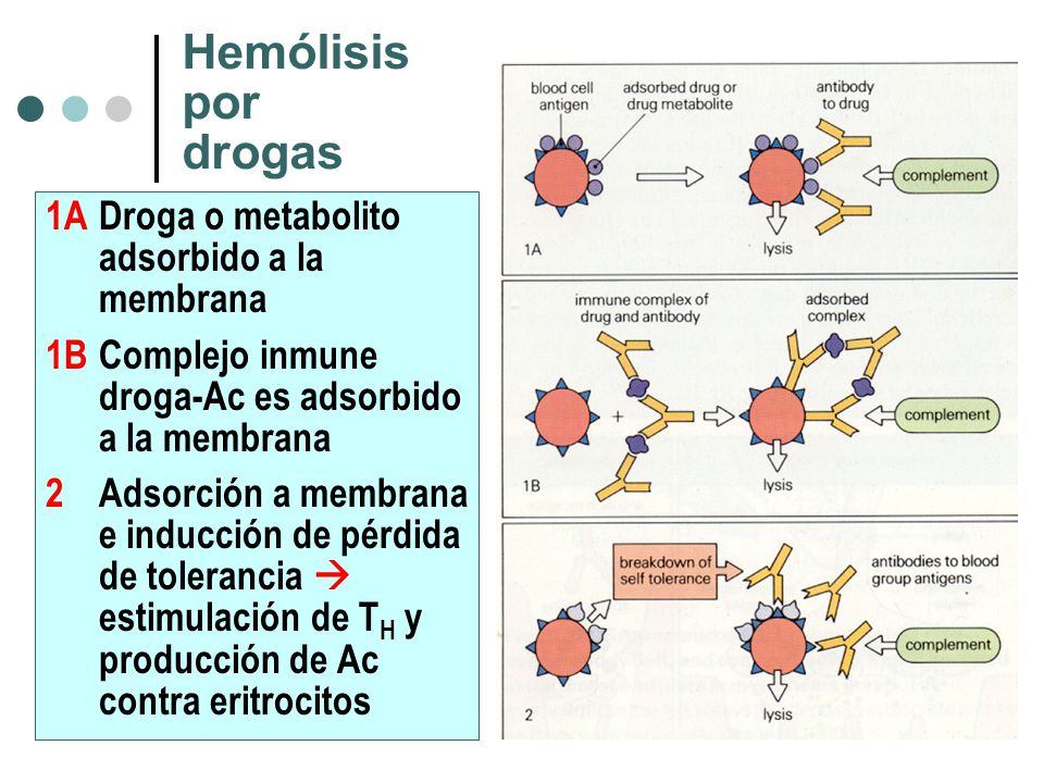 Hemólisis por drogas 1A Droga o metabolito adsorbido a la membrana