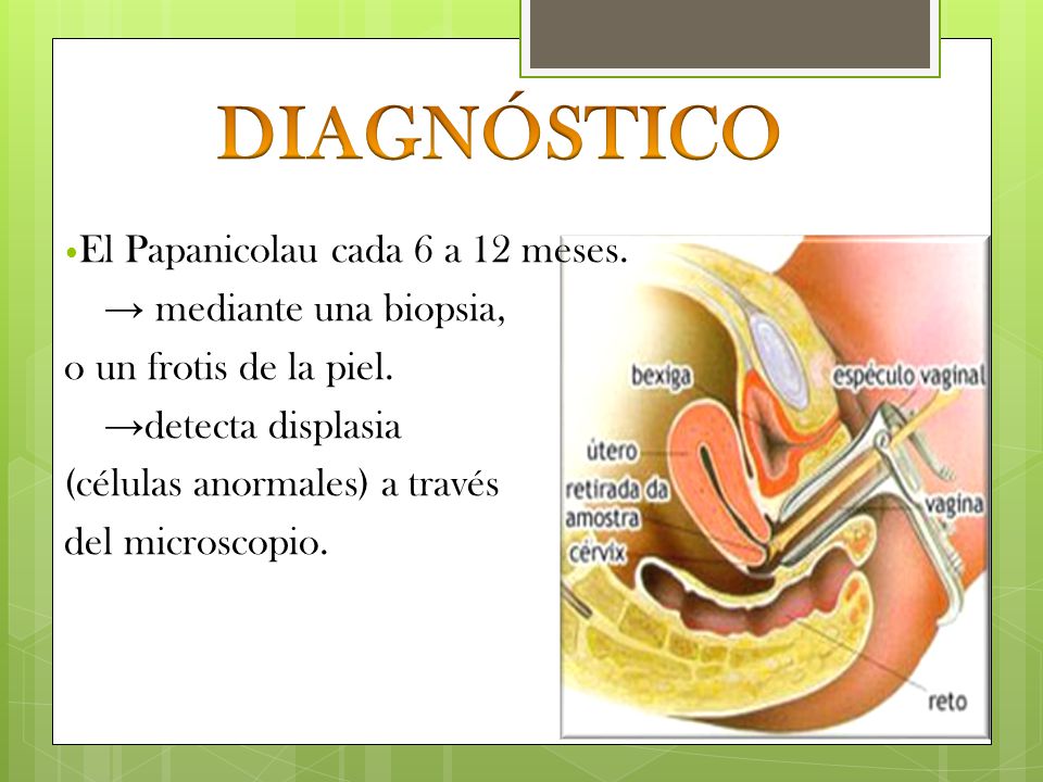 DIAGNÓSTICO El Papanicolau cada 6 a 12 meses. → mediante una biopsia,