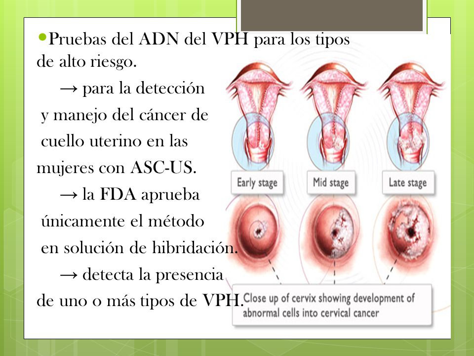 Pruebas del ADN del VPH para los tipos de alto riesgo.