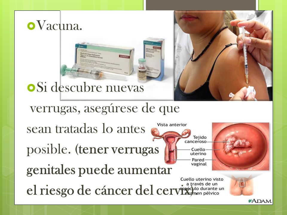 Vacuna. Si descubre nuevas. verrugas, asegúrese de que. sean tratadas lo antes. posible. (tener verrugas.