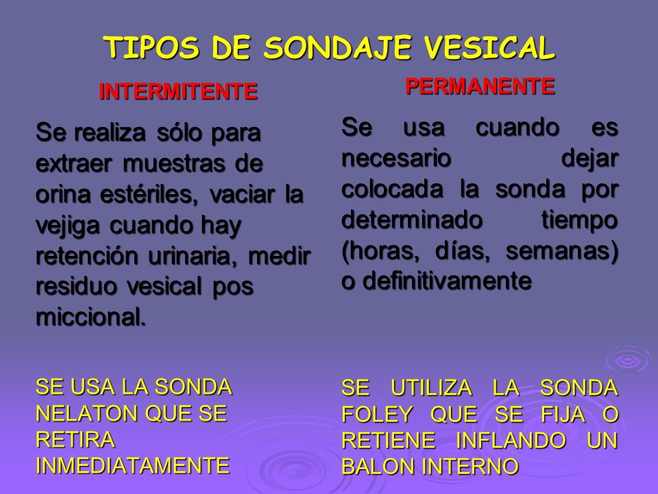 TIPOS DE SONDAJE VESICAL