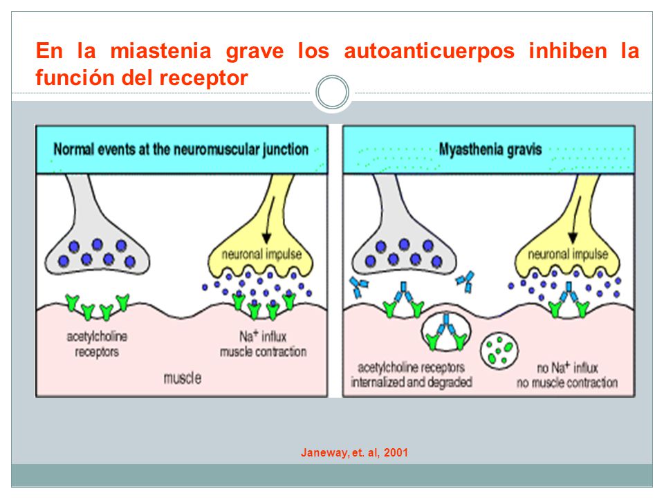 En la miastenia grave los autoanticuerpos inhiben la función del receptor