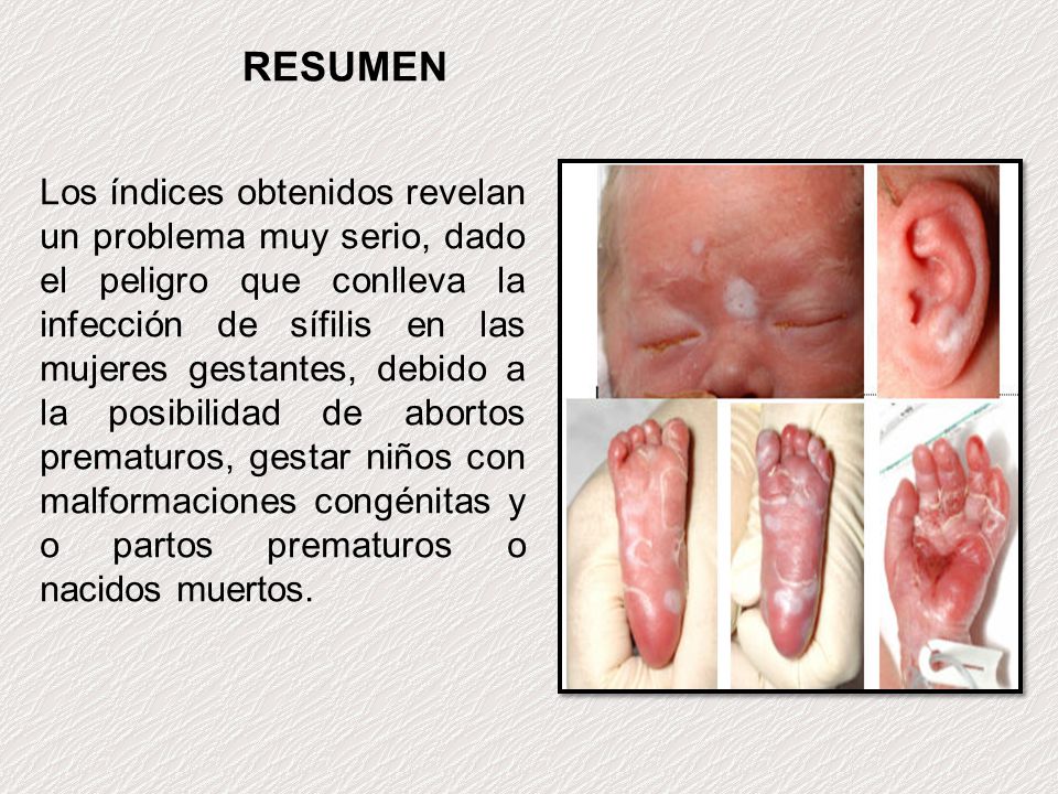 RESUMEN