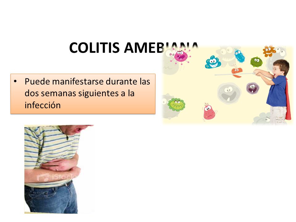COLITIS AMEBIANA Puede manifestarse durante las dos semanas siguientes a la infección