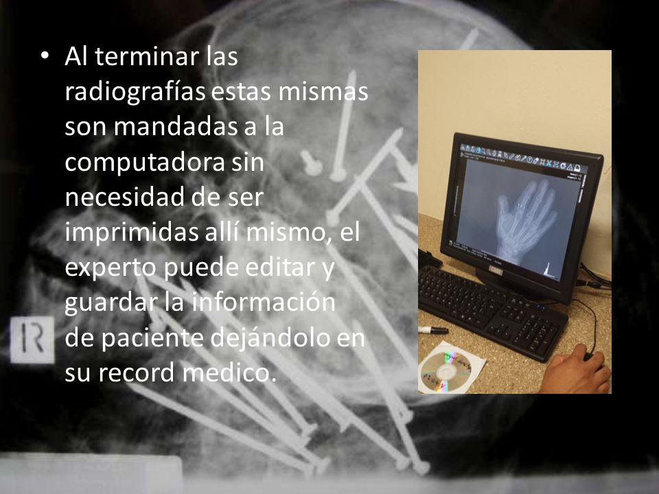 Al terminar las radiografías estas mismas son mandadas a la computadora sin necesidad de ser imprimidas allí mismo, el experto puede editar y guardar la información de paciente dejándolo en su record medico.