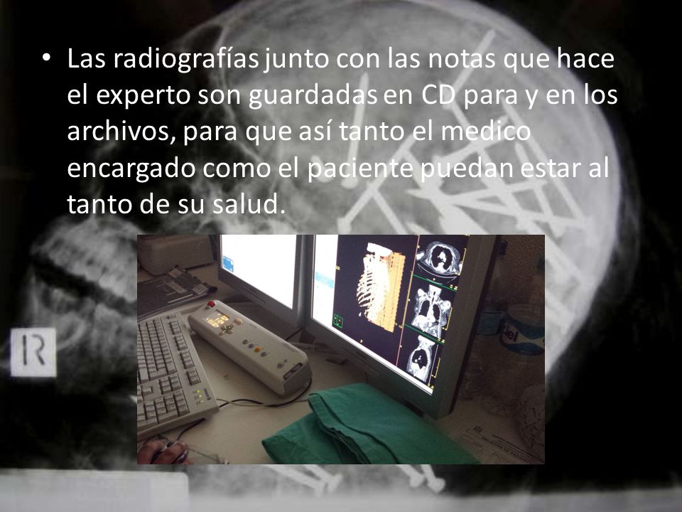 Las radiografías junto con las notas que hace el experto son guardadas en CD para y en los archivos, para que así tanto el medico encargado como el paciente puedan estar al tanto de su salud.