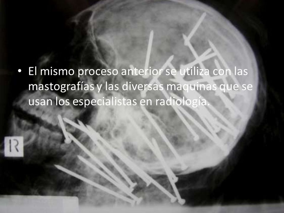 El mismo proceso anterior se utiliza con las mastografías y las diversas maquinas que se usan los especialistas en radiología.