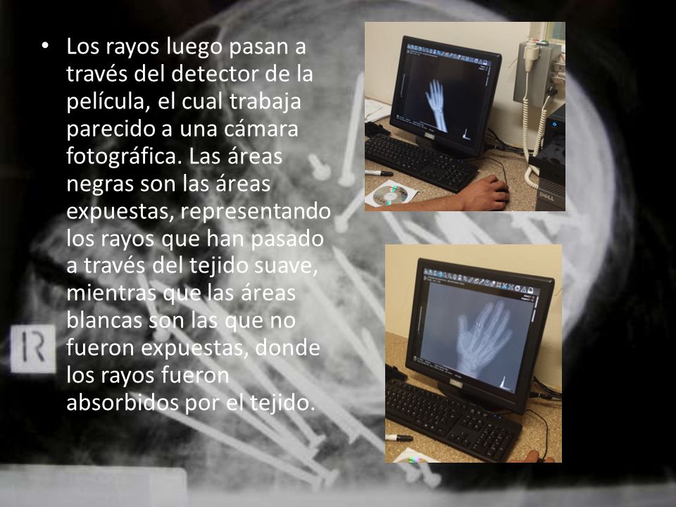 Los rayos luego pasan a través del detector de la película, el cual trabaja parecido a una cámara fotográfica.