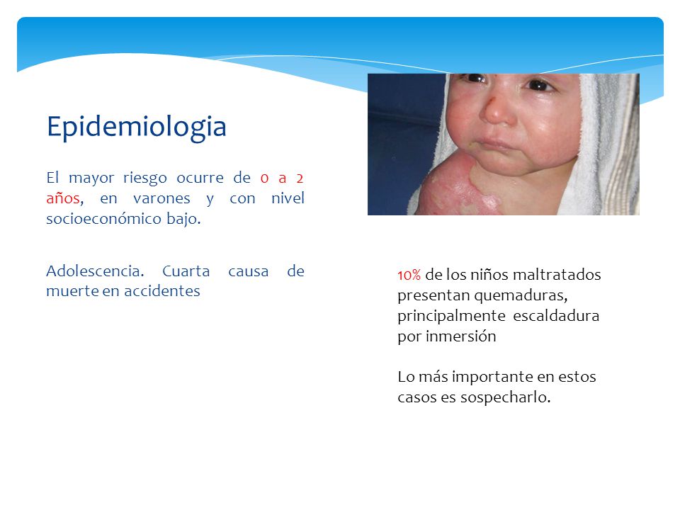 Epidemiologia El mayor riesgo ocurre de 0 a 2 años, en varones y con nivel socioeconómico bajo.