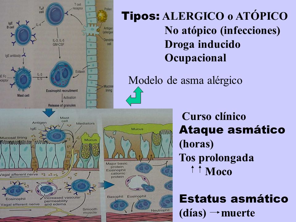 Tipos: ALERGICO o ATÓPICO No atópico (infecciones) Droga inducido