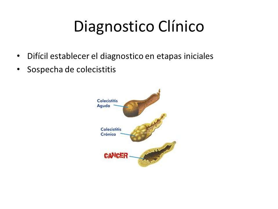 Diagnostico Clínico Difícil establecer el diagnostico en etapas iniciales Sospecha de colecistitis