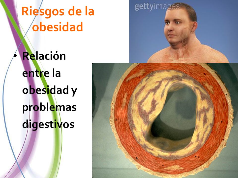 Riesgos de la obesidad Relación entre la obesidad y problemas digestivos.