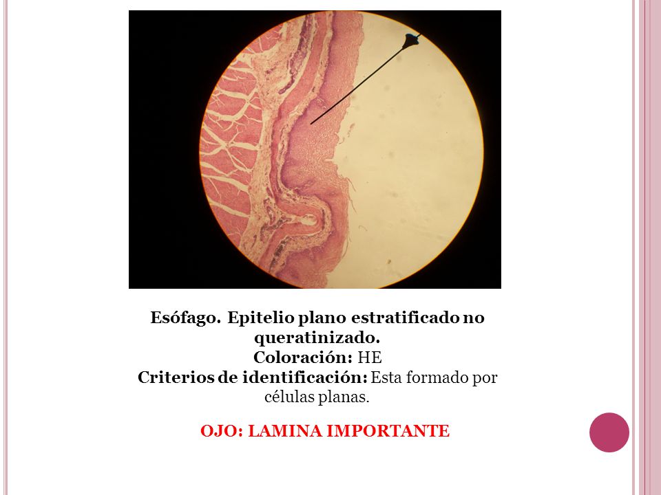 Esófago. Epitelio plano estratificado no queratinizado. Coloración: HE